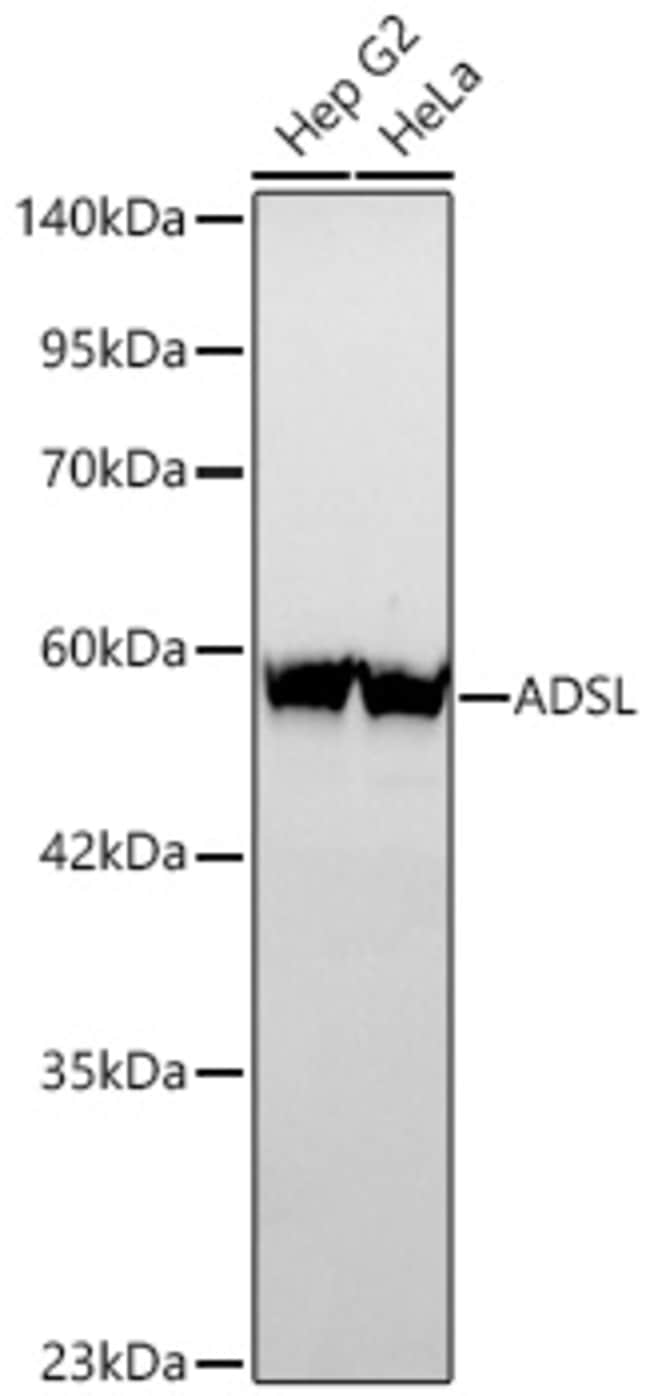 ADSL RMAB 100 UL