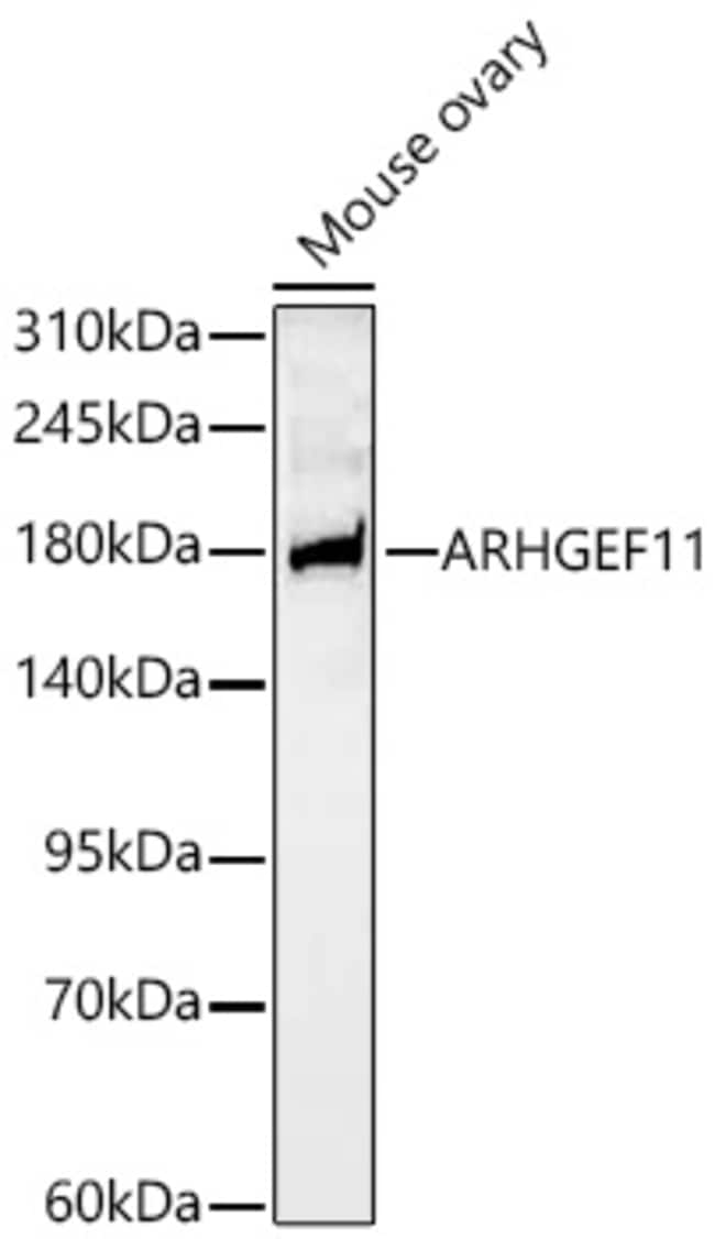 ARHGEF11 RMAB 100 UL
