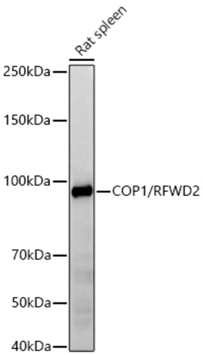 RFWD2 RMAB 100 UL