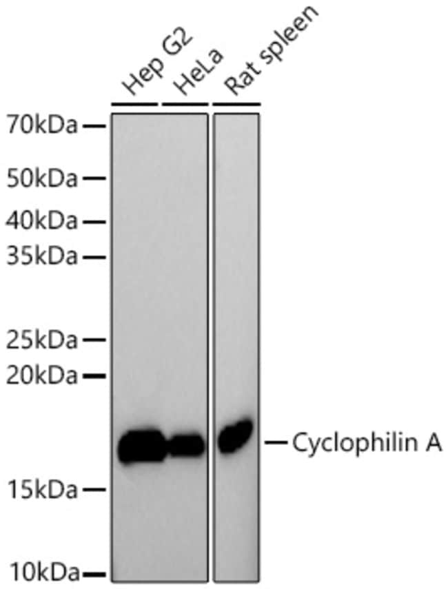 CYCLOPHILIN A RMAB 100 UL