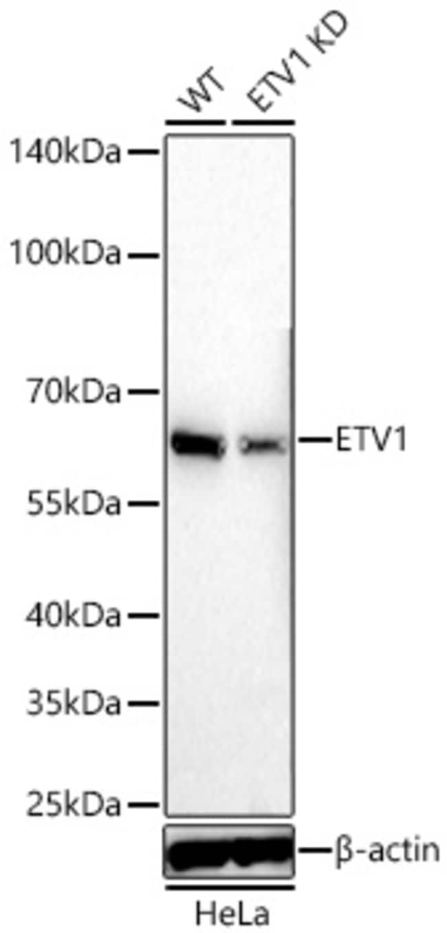 ETV1 RMAB 100 UL