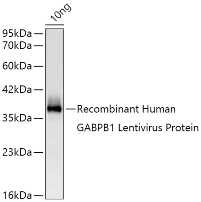 GABPB1 RMAB 100 UL