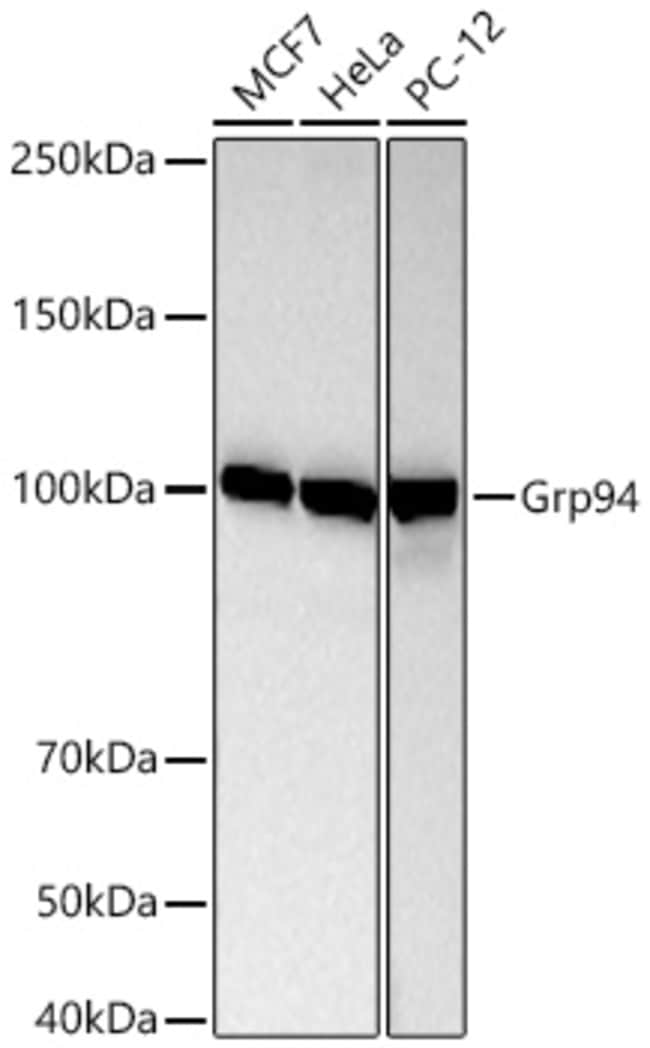 GRP94 RMAB 100 UL