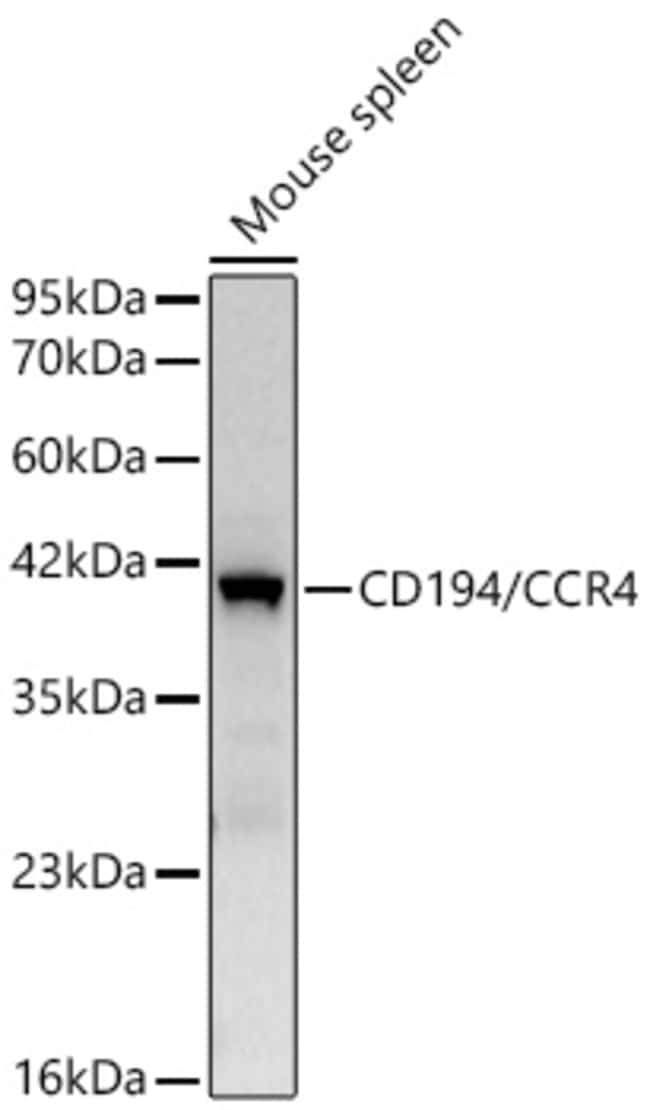 CCR4 RMAB 100 UL