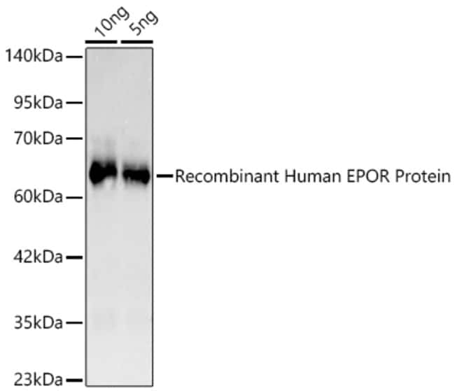 EPOR RMAB 100 UL
