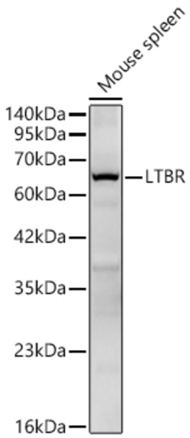 LTBR RMAB 100 UL