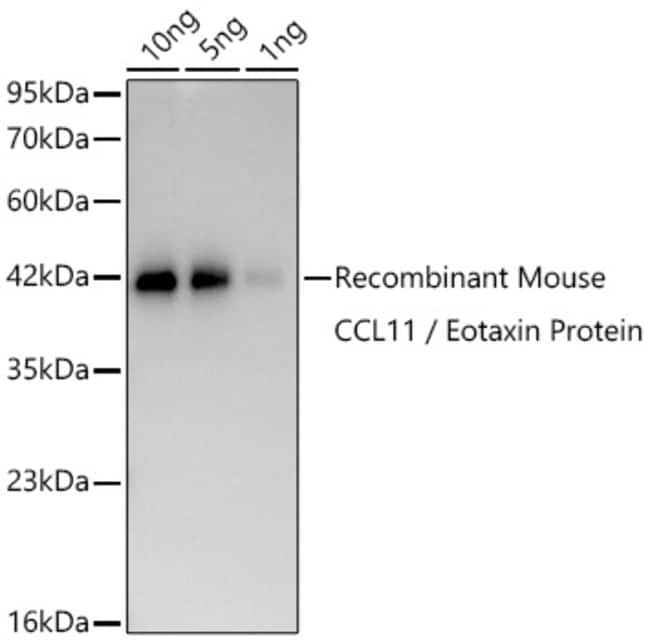 EOTAXIN RMAB 100 UL