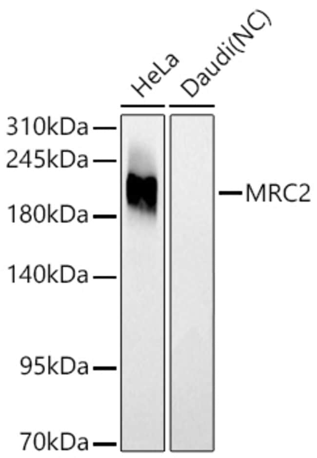 MRC2 RMAB 100 UL