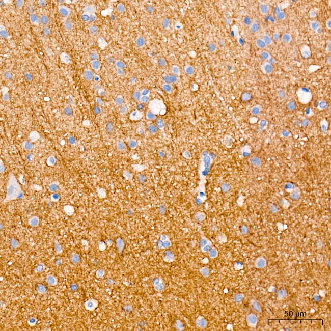 SCN3B RMAB 100 UL