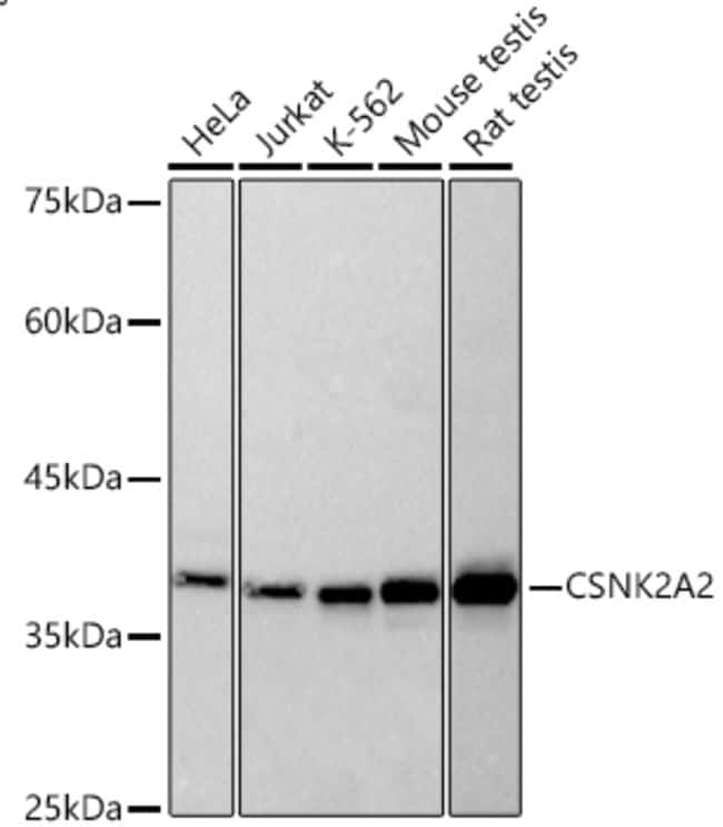 CK2 ALPHA-2 RMAB 100 UL