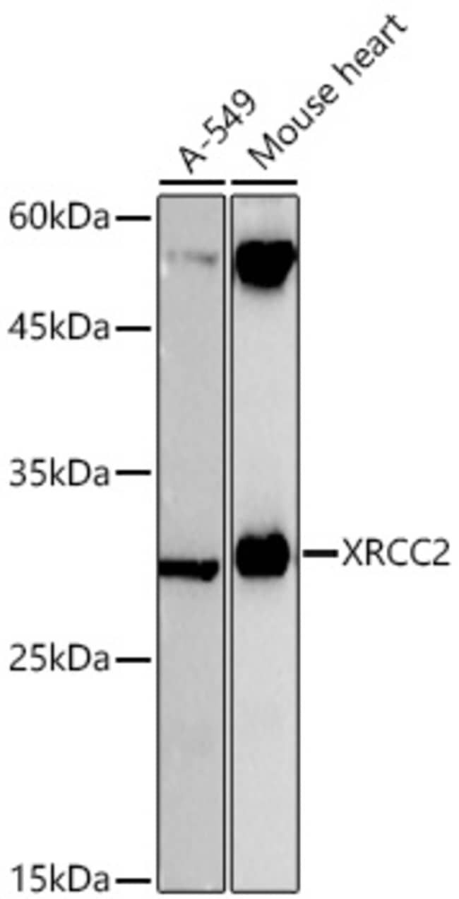 XRCC2 RMAB 100 UL