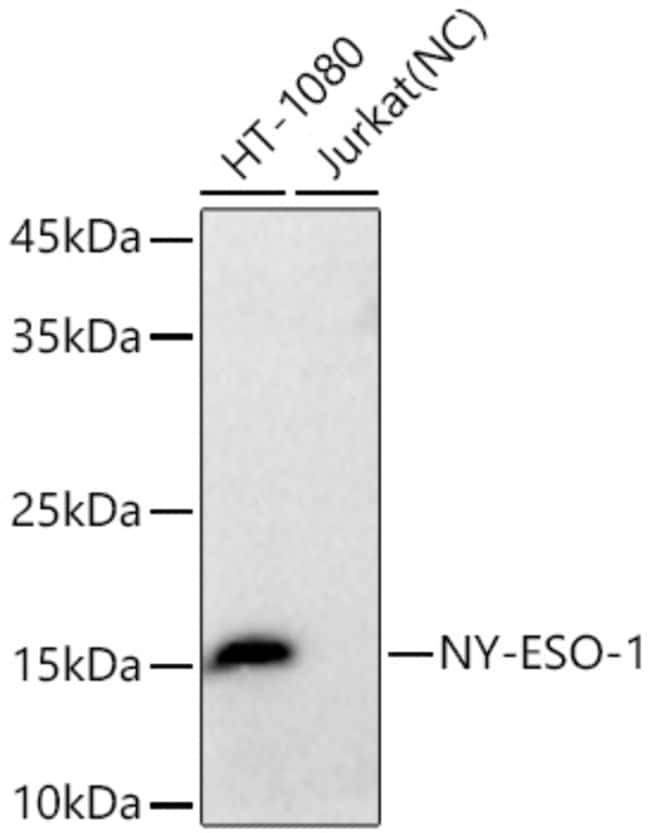 NY-ESO-1 RMAB 100 UL
