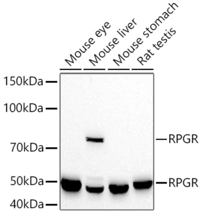 RPGR RMAB 100 UL