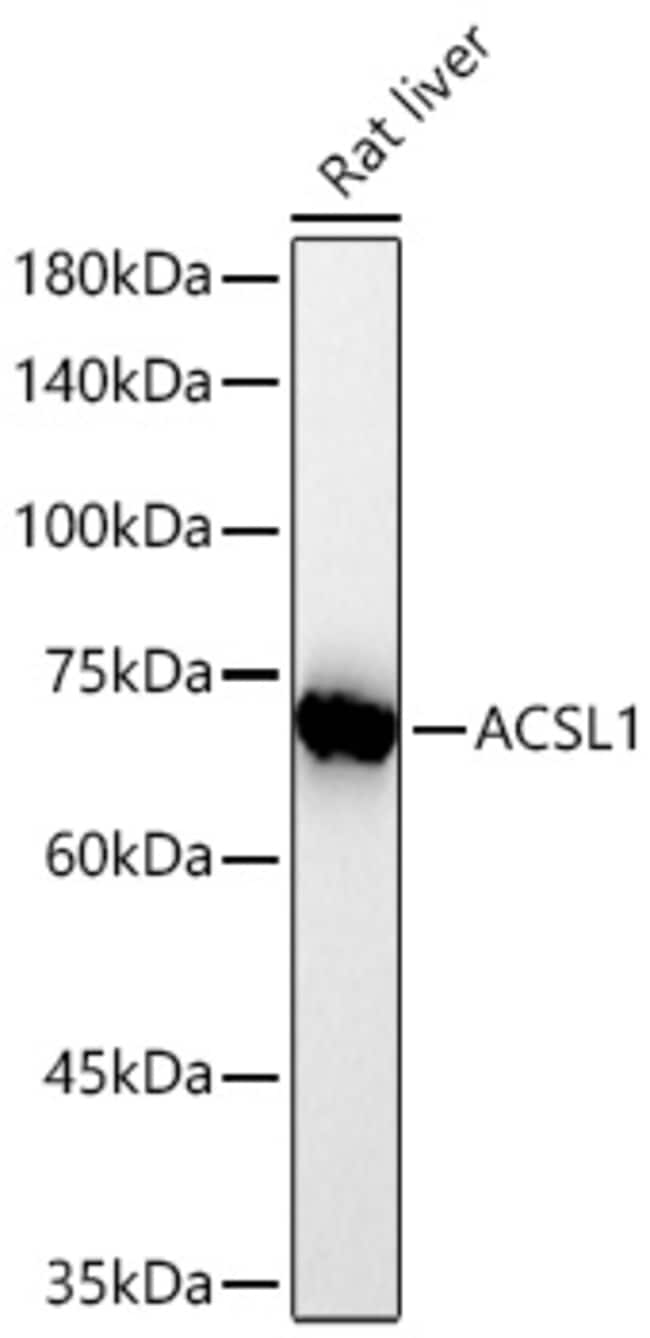 ACSL1 RMAB 100 UL