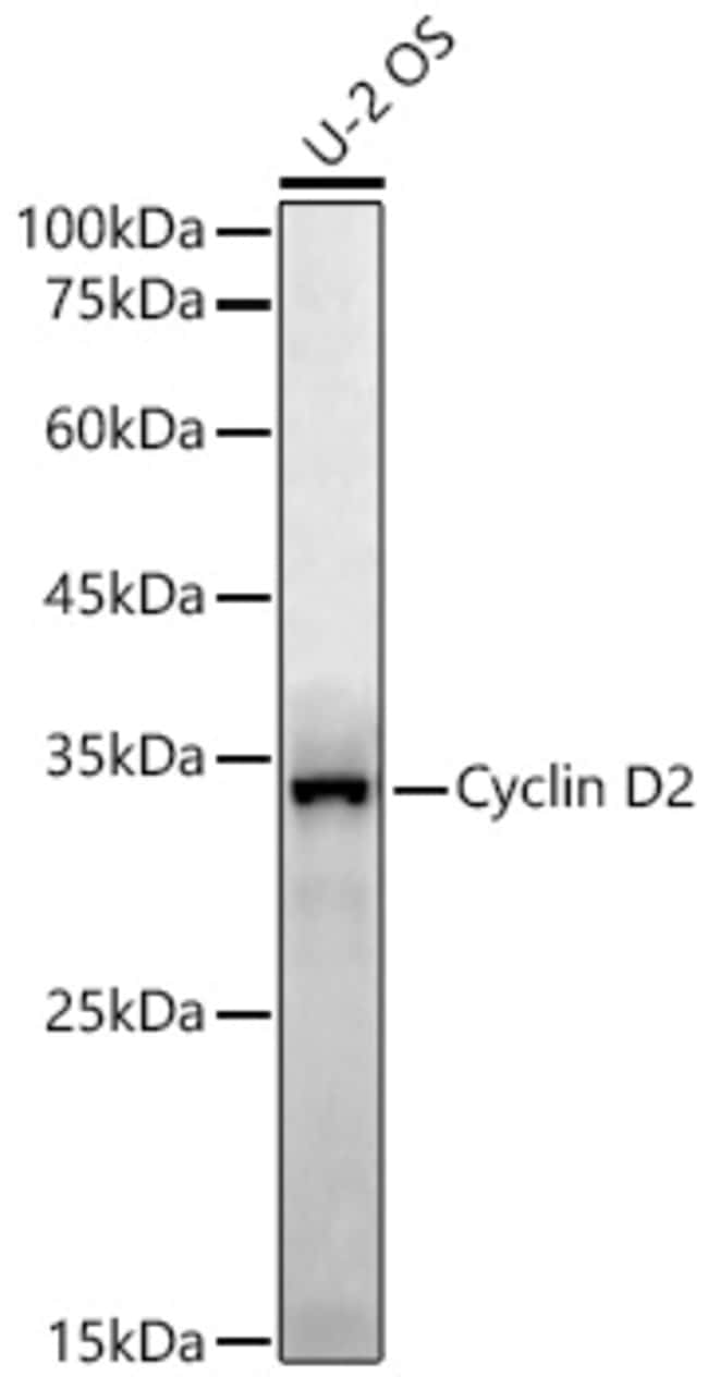 CYCLIN D2 RMAB 100 UL