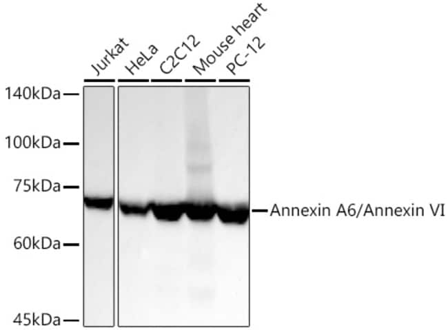ANNEXIN A6 RMAB 100 UL