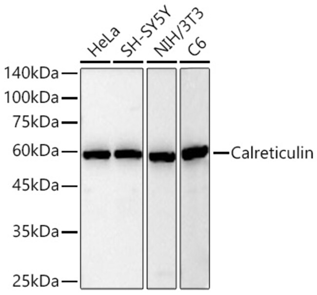 CALRETICULIN RMAB 100 UL
