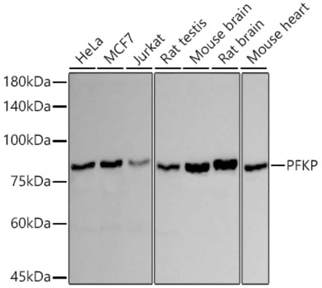 PFKP RMAB 100 UL