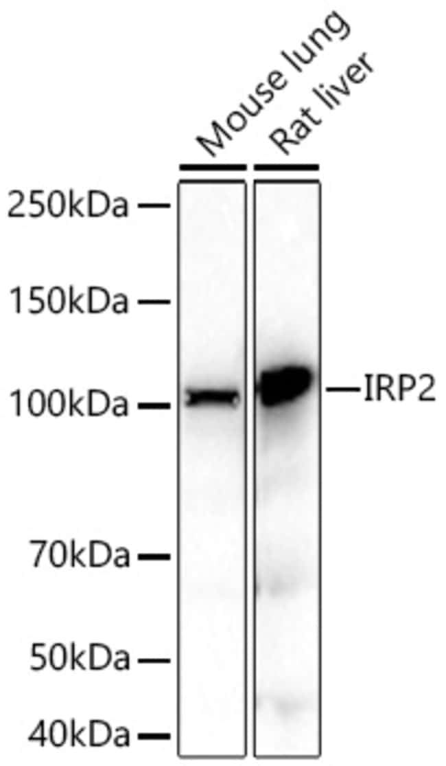 IREB2 RMAB 100 UL