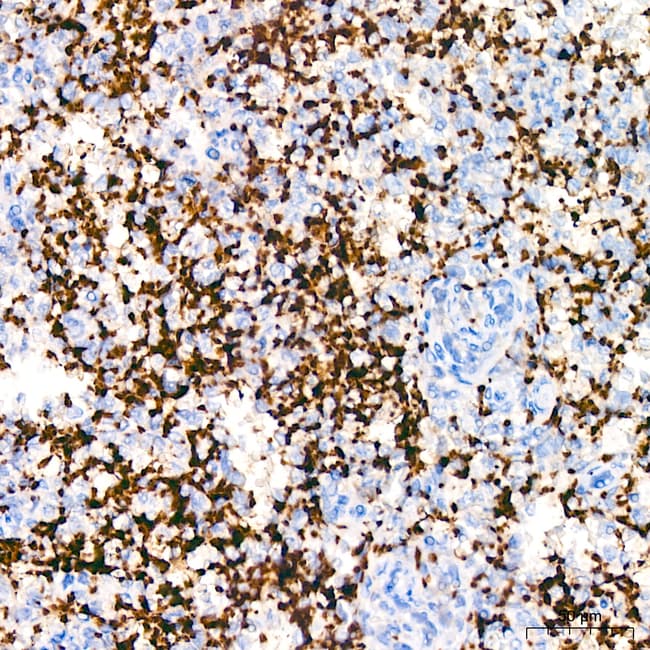 CD42B RMAB 100 UL