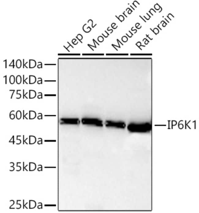 IP6K1 RMAB 100 UL
