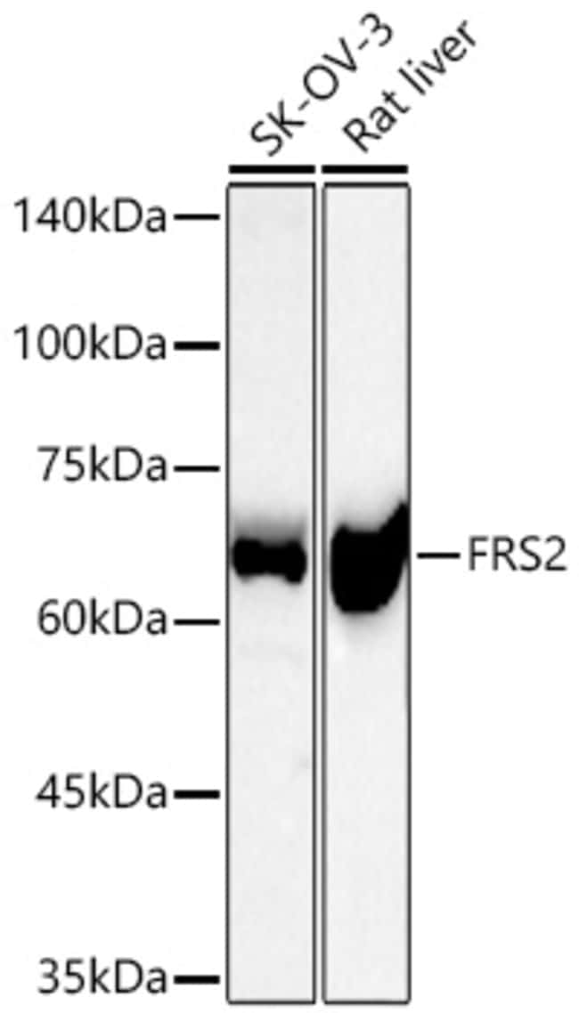 FRS2 RMAB 100 UL