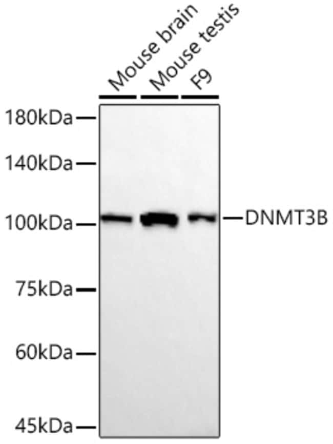 DNMT3B RMAB 100 UL