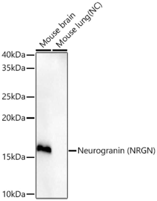 NRGN RMAB 100 UL