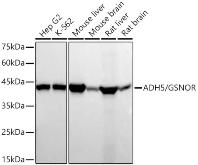 ADH5 RMAB 100 UL