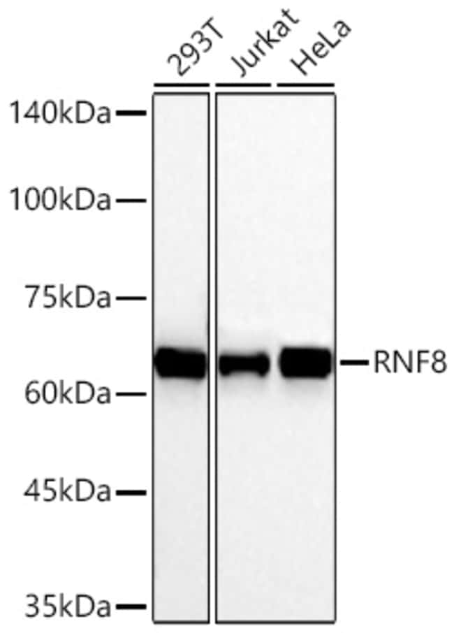 RNF8 RMAB 100 UL