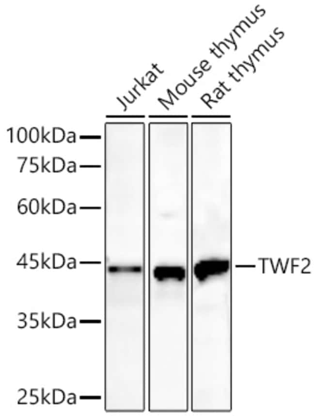 TWF2 RMAB 100 UL