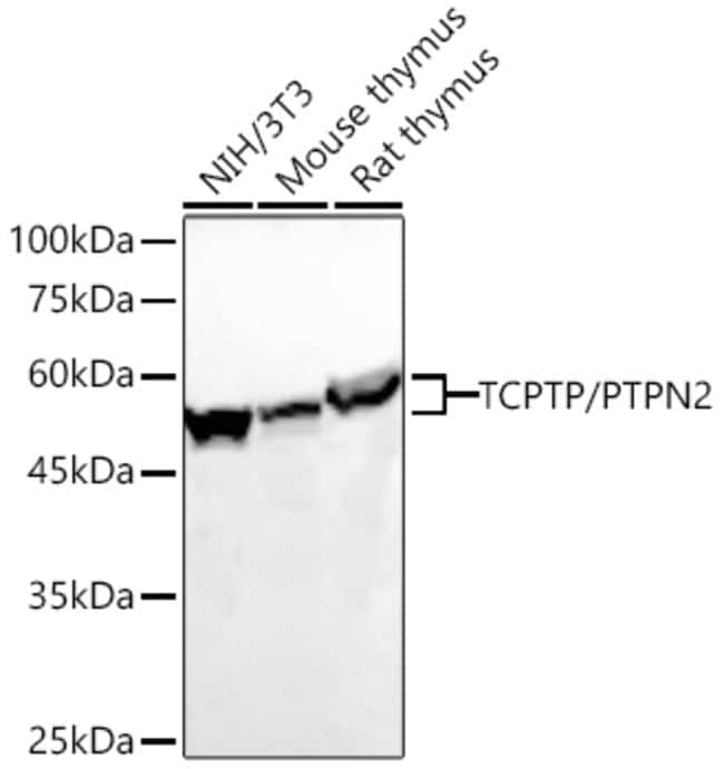 PTPN2 RMAB 100 UL