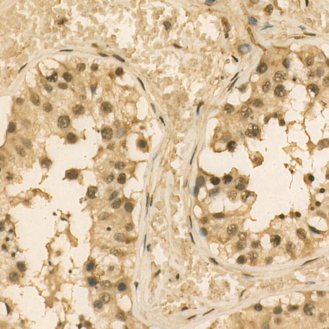 PSMC4 RMAB 100 UL