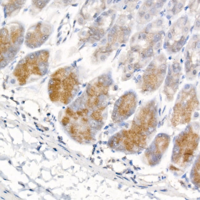 PEPSINOGEN I RMAB 100 UL