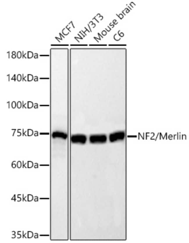 NF2 RMAB 100 UL