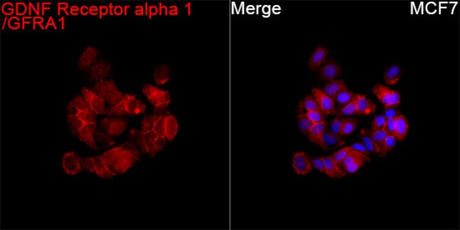 GFR ALPHA-1 RMAB 100 UL