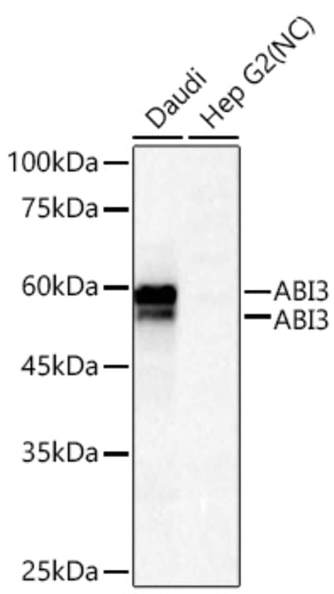 ABI3 RMAB 100 UL