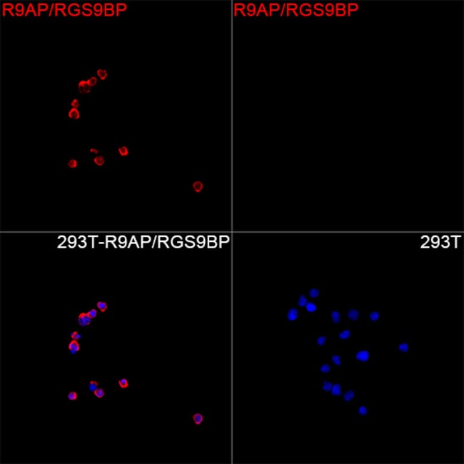 R9BP RMAB 100 UL