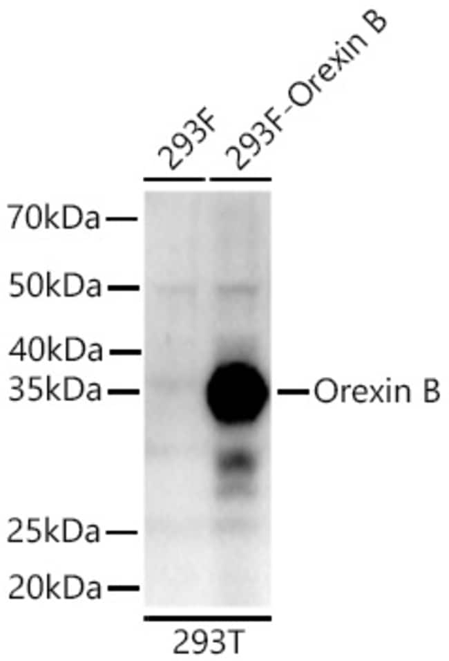 OREXIN B RMAB 100 UL