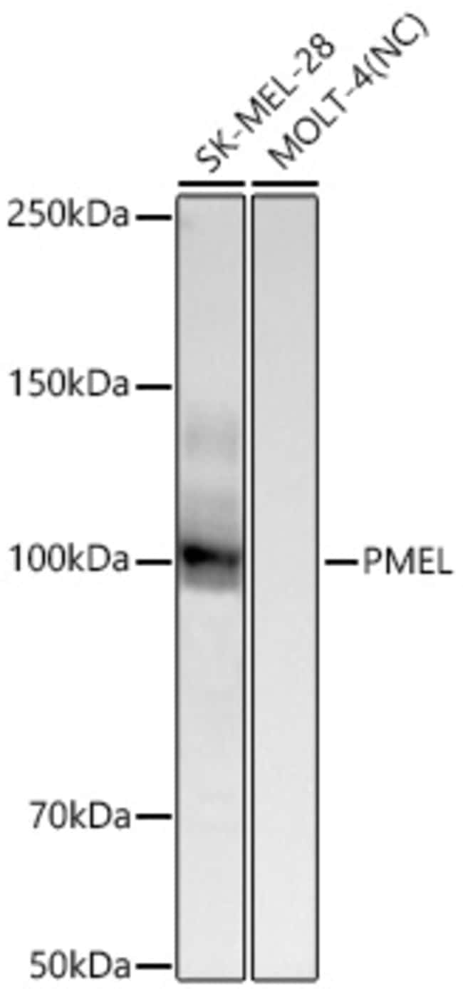 PMEL RMAB 100 UL