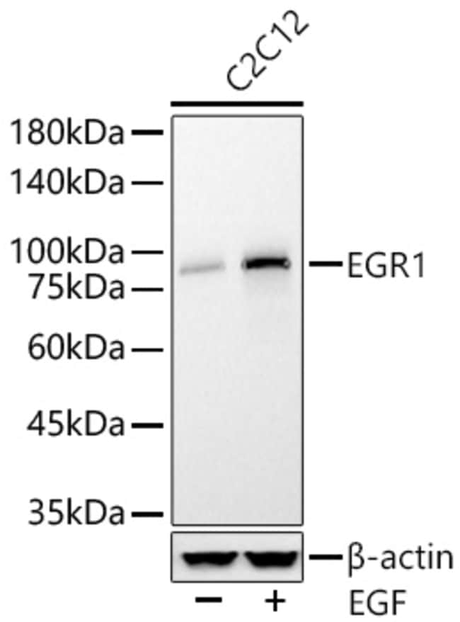 EGR1 RMAB 100 UL