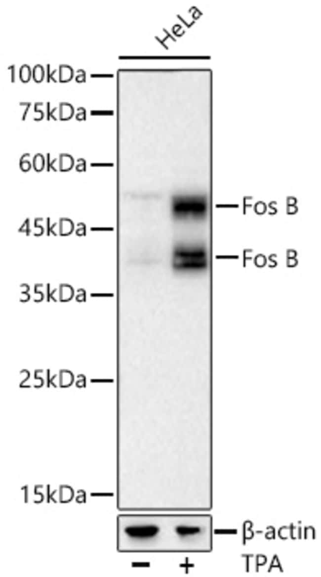 FOSB RMAB 100 UL