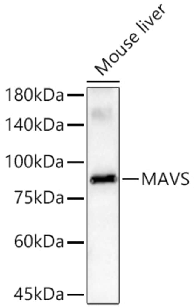 MAVS RMAB 100 UL