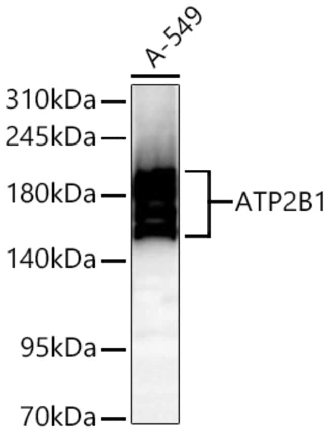 PMCA1 ATPASE RMAB 100 UL
