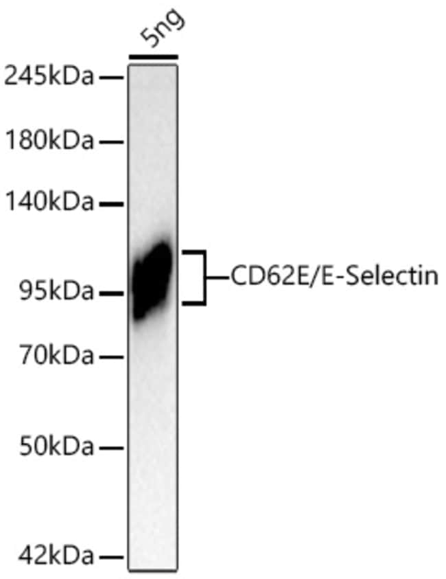 CD62E (E-SELECTIN) RMAB 100 UL