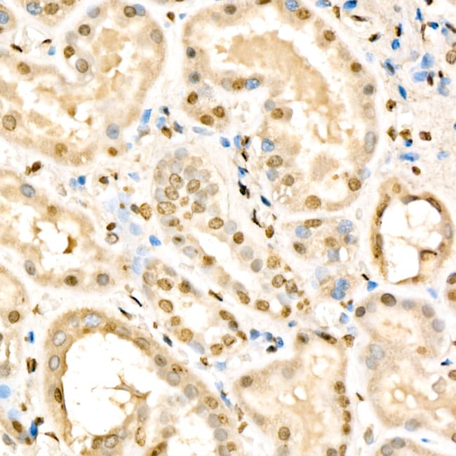 RXRB RMAB 100 UL
