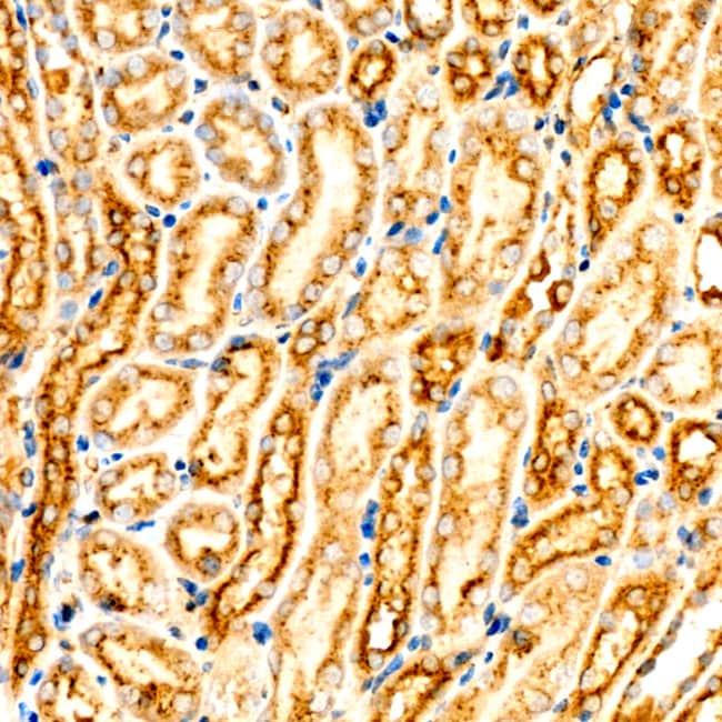 ASM RMAB 100 UL