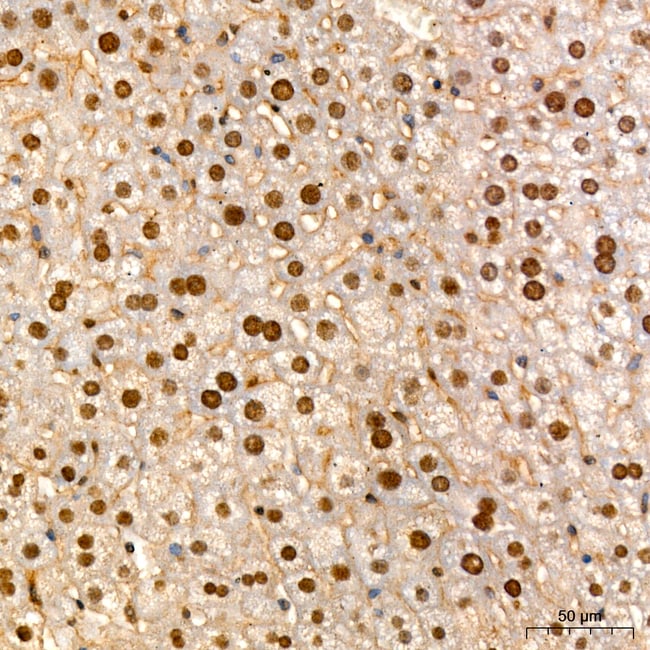 HNF6 RMAB 100 UL