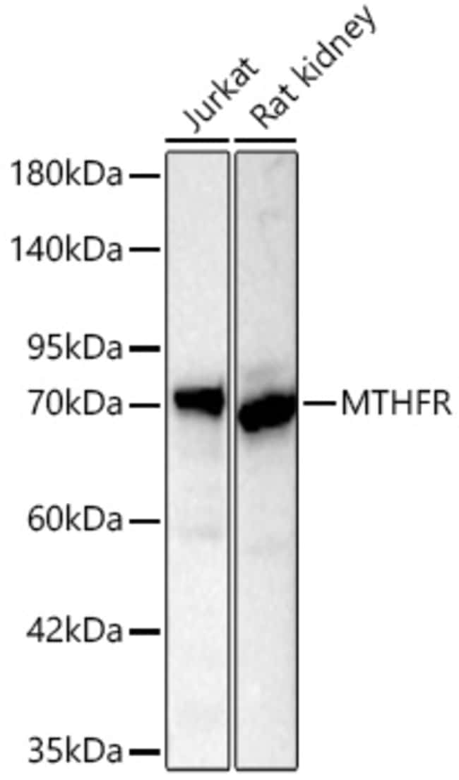 MTHFR RMAB 100 UL