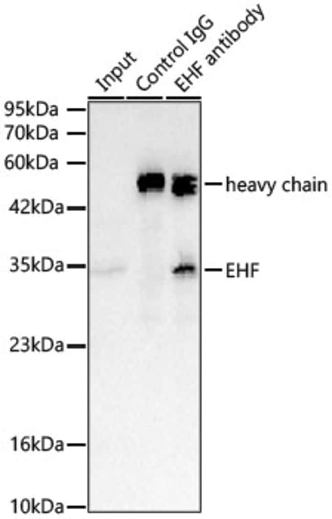 EHF RMAB 100 UL